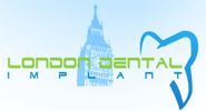 Отзыв от London Dental Implant